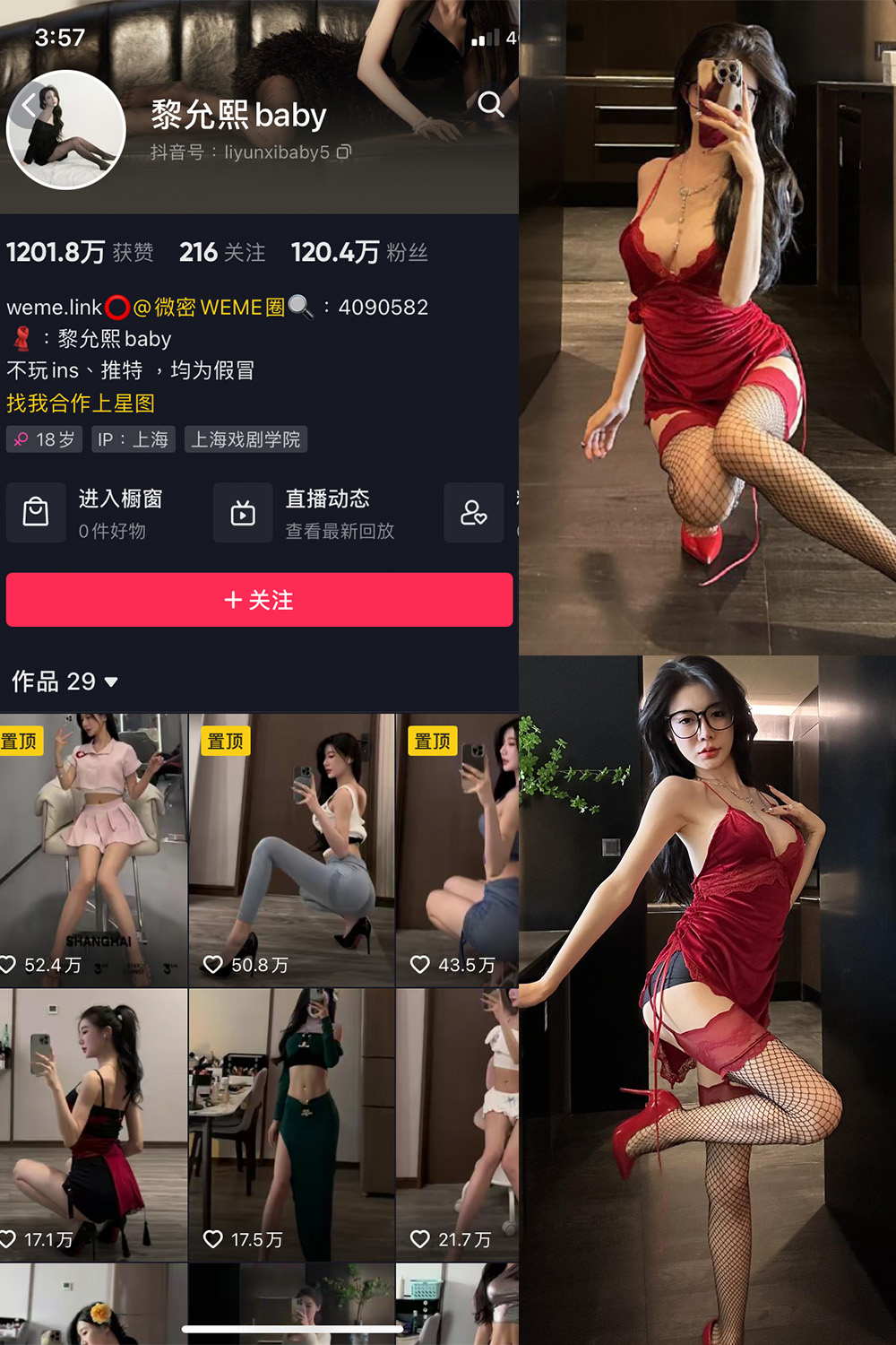 图片[1]-抖音 黎允熙baby 微密圈  NO.041期  32P5V 最新至 2023.11.27-慕色阁