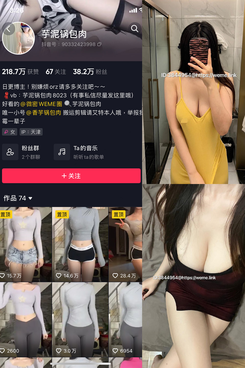 图片[1]-抖音 芋泥锅包肉 微密圈  NO.008期  11P1V-慕色阁