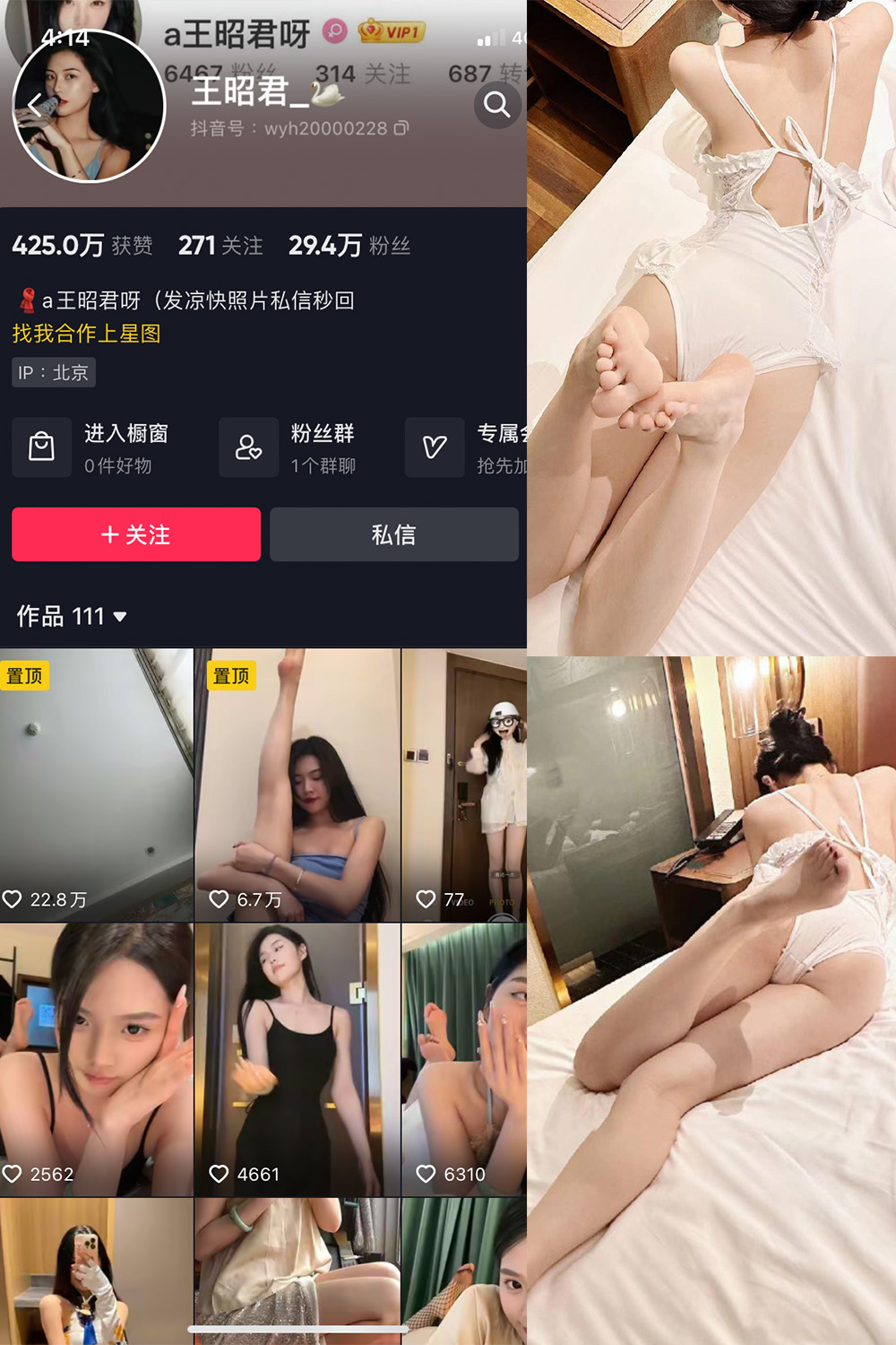图片[1]-抖音 王昭君 微密圈  NO.023期  29P6V 最新至 2024.6.6-慕色阁