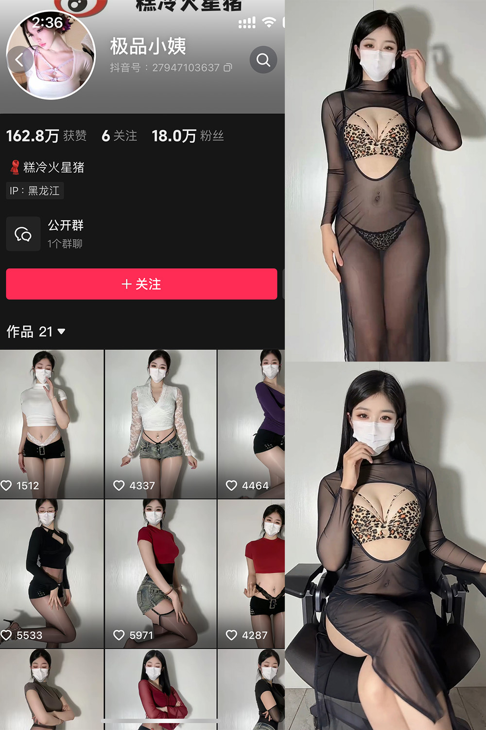 抖音 极品小姨 微密圈  NO.017期 【6P】最新至：2025.4.5-秀人网