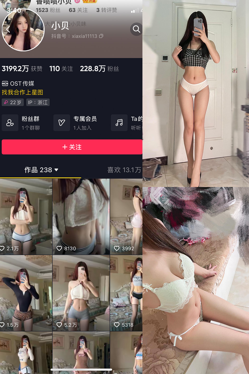 图片[1]-抖音 小贝 VIP 微密圈 NO.012期  25P4V-慕色阁