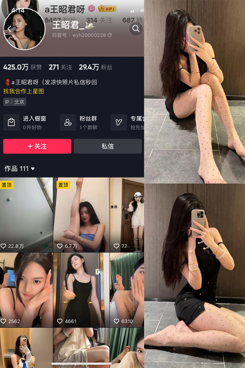 图片[1]-抖音 王昭君 微密圈  NO.022期  25P6V 最新至 2024.3.13-慕色阁