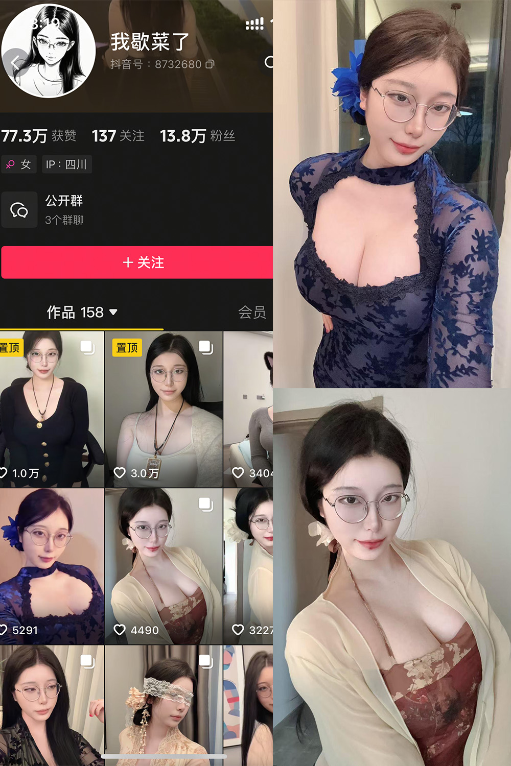 抖音 我歇菜了 微密圈 NO.001期 【10P】最新至：2025.4.18-秀人网