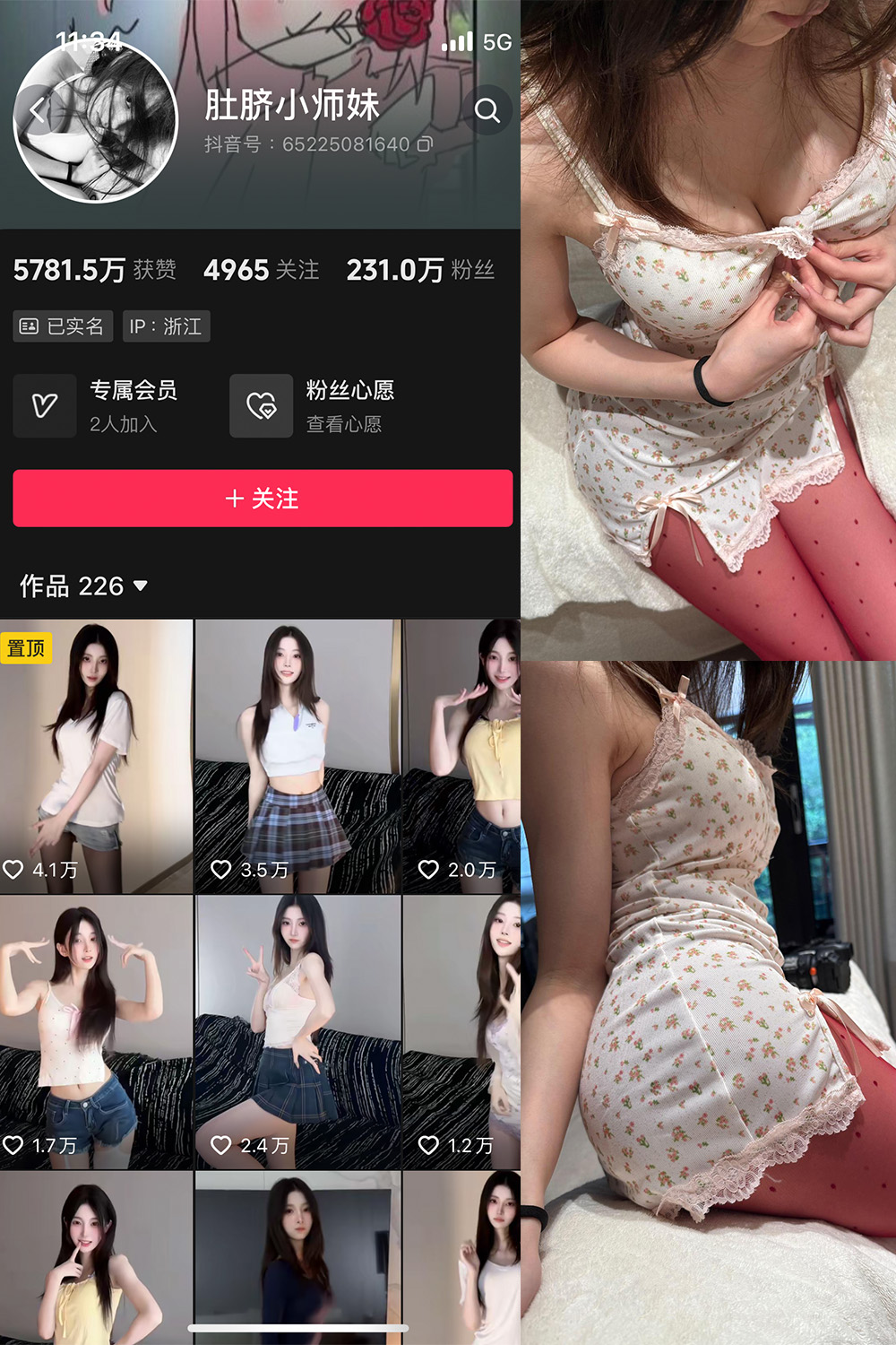 抖音 肚脐小师妹 微密圈  NO.037期 【15P】最新至：2025.4.13-秀人网