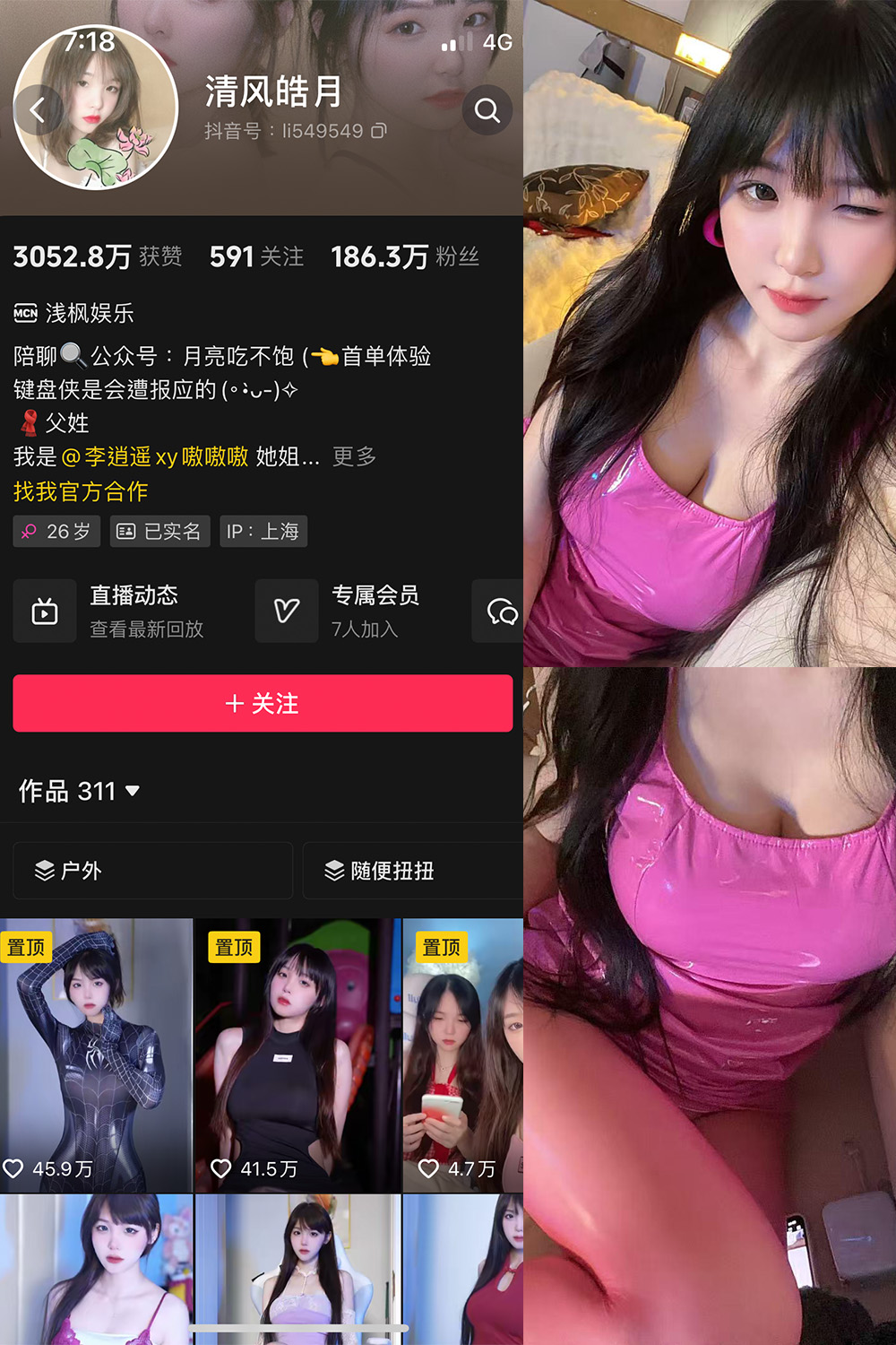 抖音 清风皓月 微密圈 | 觅圈  NO.003期 【18P】最新至：2025.5.25-秀人网