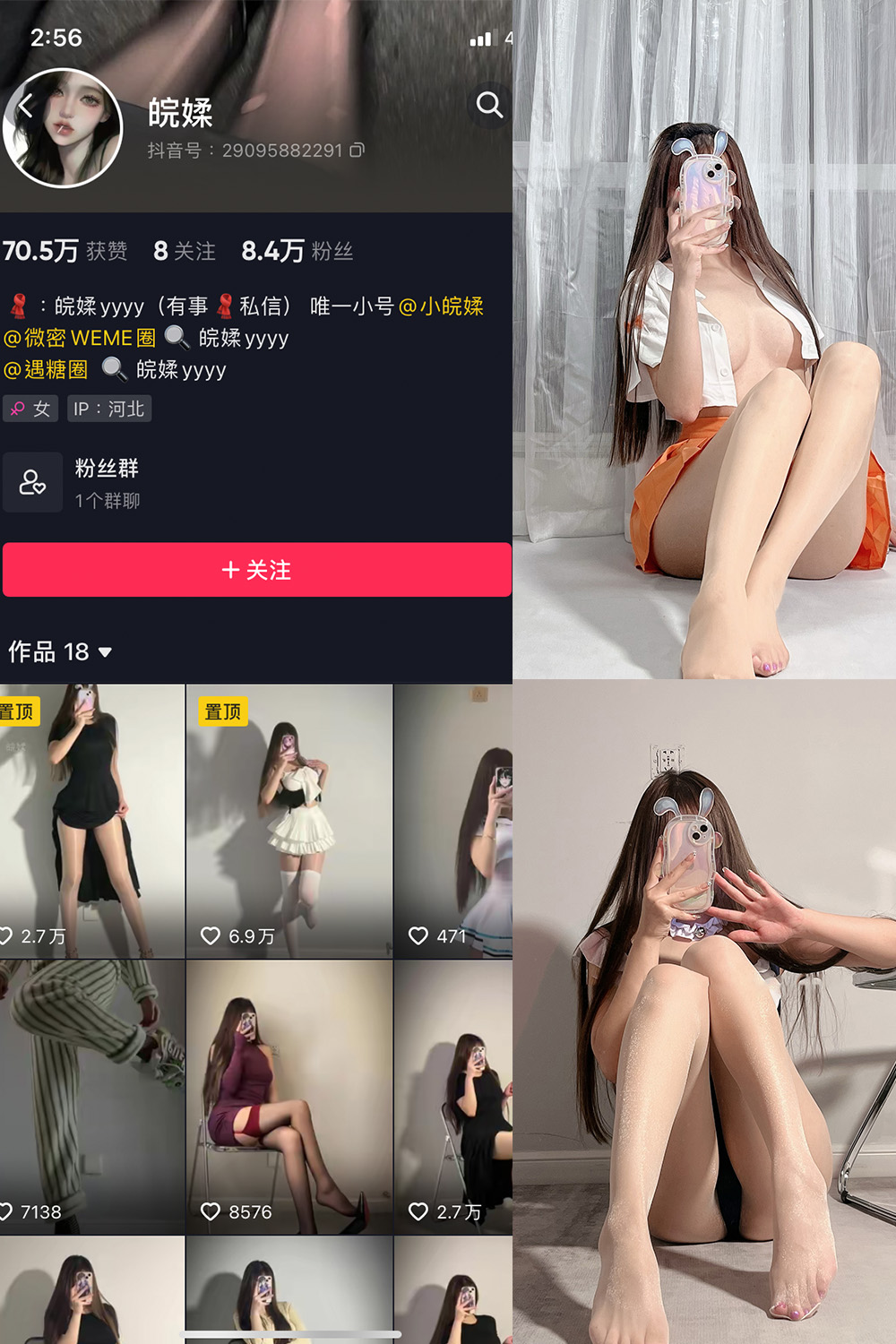 图片[1]-抖音 皖媃yyyy VIP 微密圈  NO.002期  20V-慕色阁