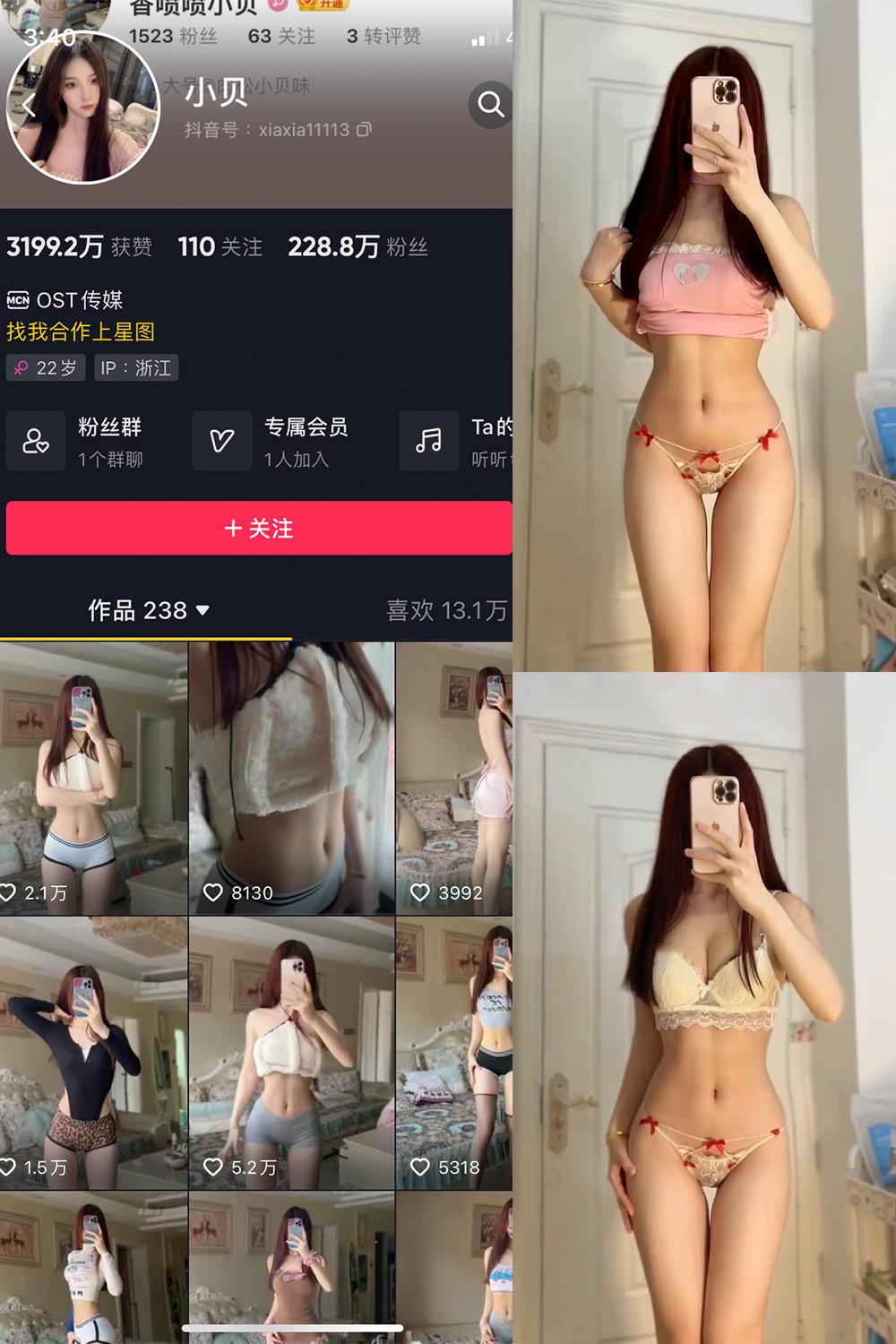 图片[1]-抖音 小贝 VIP 微密圈 NO.013期  19P6V-慕色阁