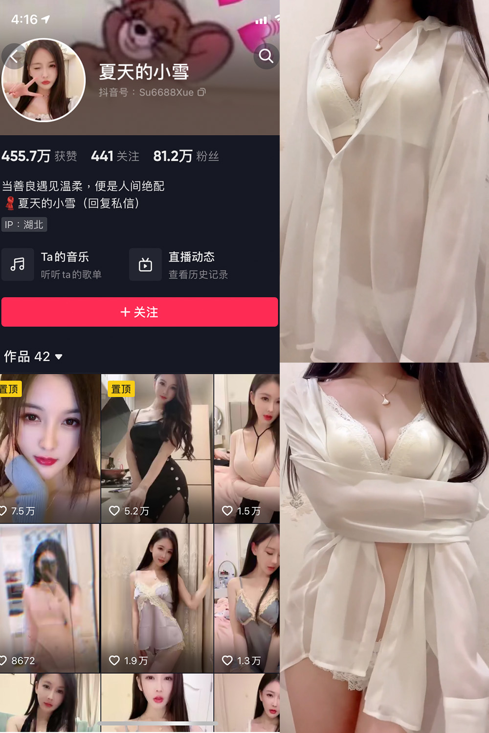 图片[1]-抖音 夏天的小雪 微密圈 嘉宾专享 NO.001 011期 最新至 2023.8.11-慕色阁