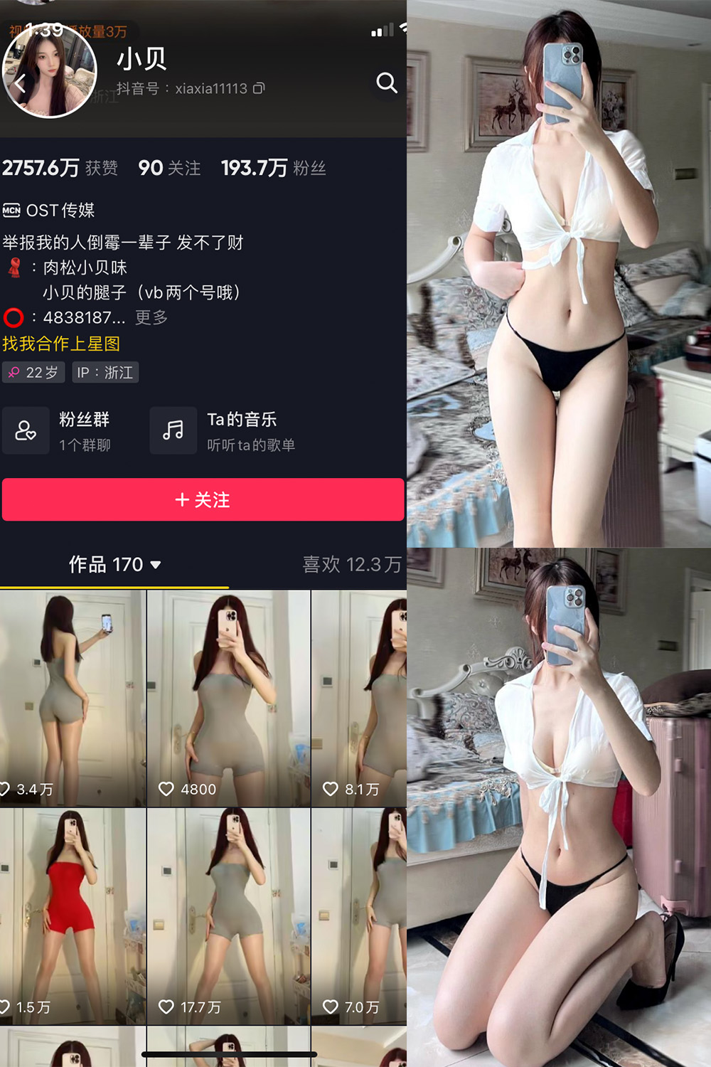 图片[1]-抖音 小贝 VIP 微密圈  NO.005期  28P-慕色阁