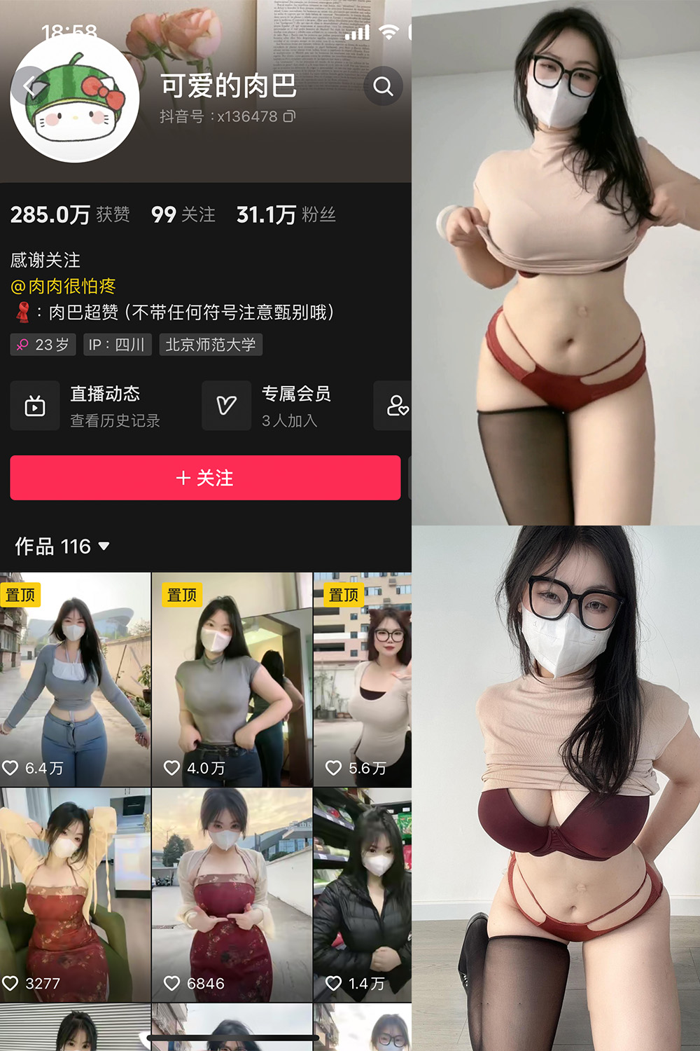 图片[1]-抖音 可爱的肉巴 微密圈  NO.009期  18P11V 最新至 2024.11.7-慕色阁