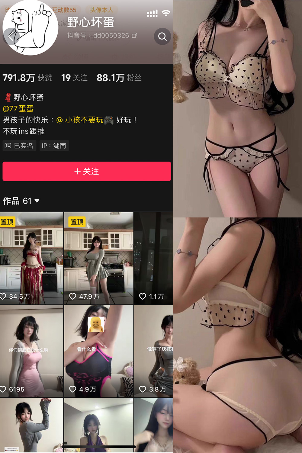 图片[1]-抖音 野心坏蛋 微密圈  NO.007期  13P 最新至 2025.1.14-慕色阁