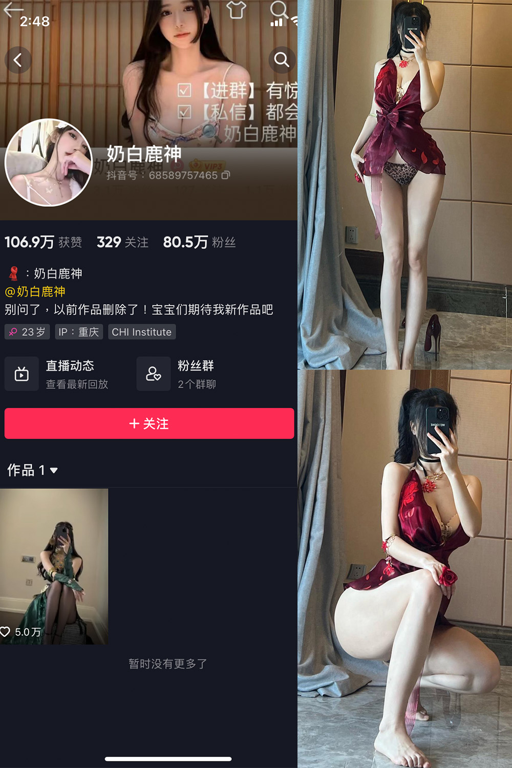 图片[1]-抖音 奶白鹿神 微密圈 NO.001 008期 最新-慕色阁