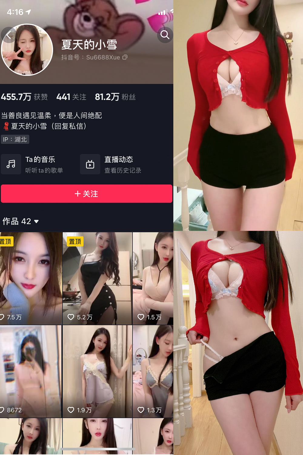 图片[1]-抖音 夏天的小雪 微密圈  NO.006期  3V-慕色阁