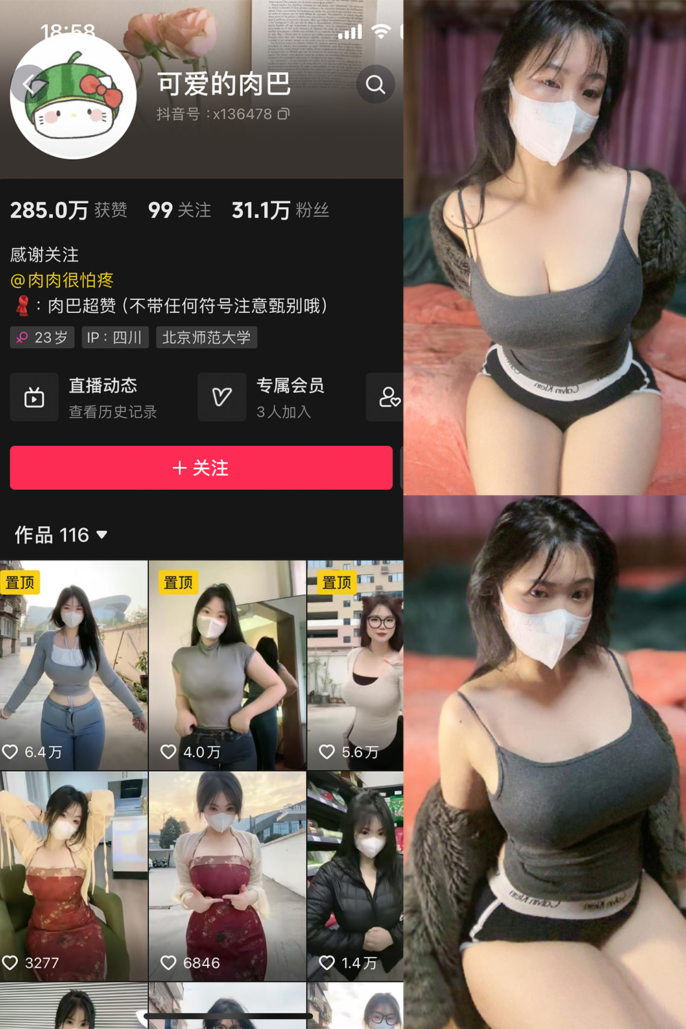 图片[1]-抖音 可爱的肉巴 微密圈  NO.011期  14P6V 最新至 2024.2.19-慕色阁