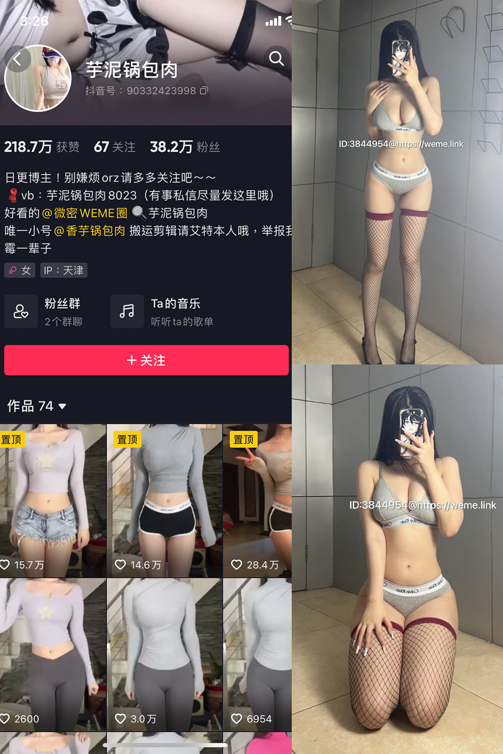 图片[1]-抖音 芋泥锅包肉 微密圈  NO.005期  16P9V-慕色阁