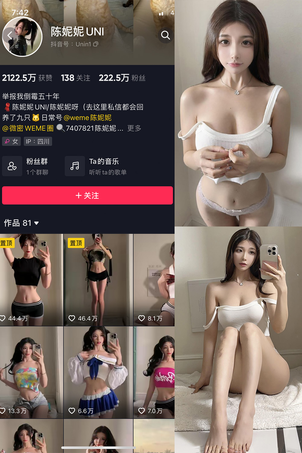 图片[1]-抖音 陈妮腻UNI 微密圈  NO.063期  24P1V-慕色阁