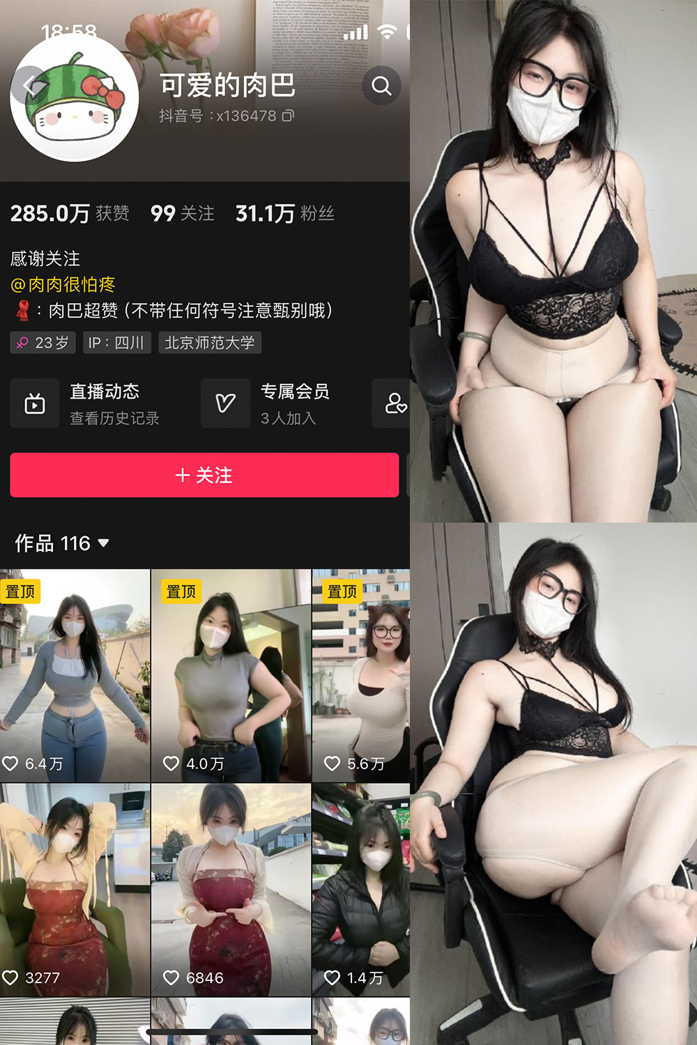 抖音 可爱的肉巴 微密圈  NO.022期  25V 最新至 2024.4.25-付费阅读
