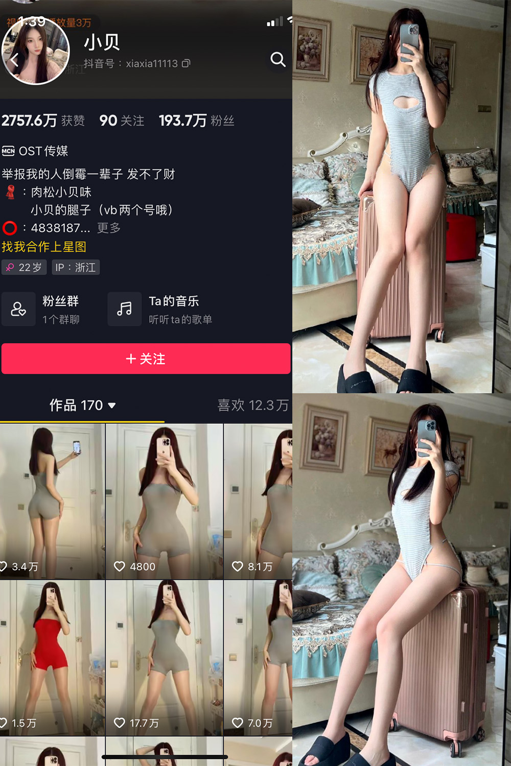 图片[1]-抖音 小贝 VIP 微密圈  NO.007期  28P-慕色阁