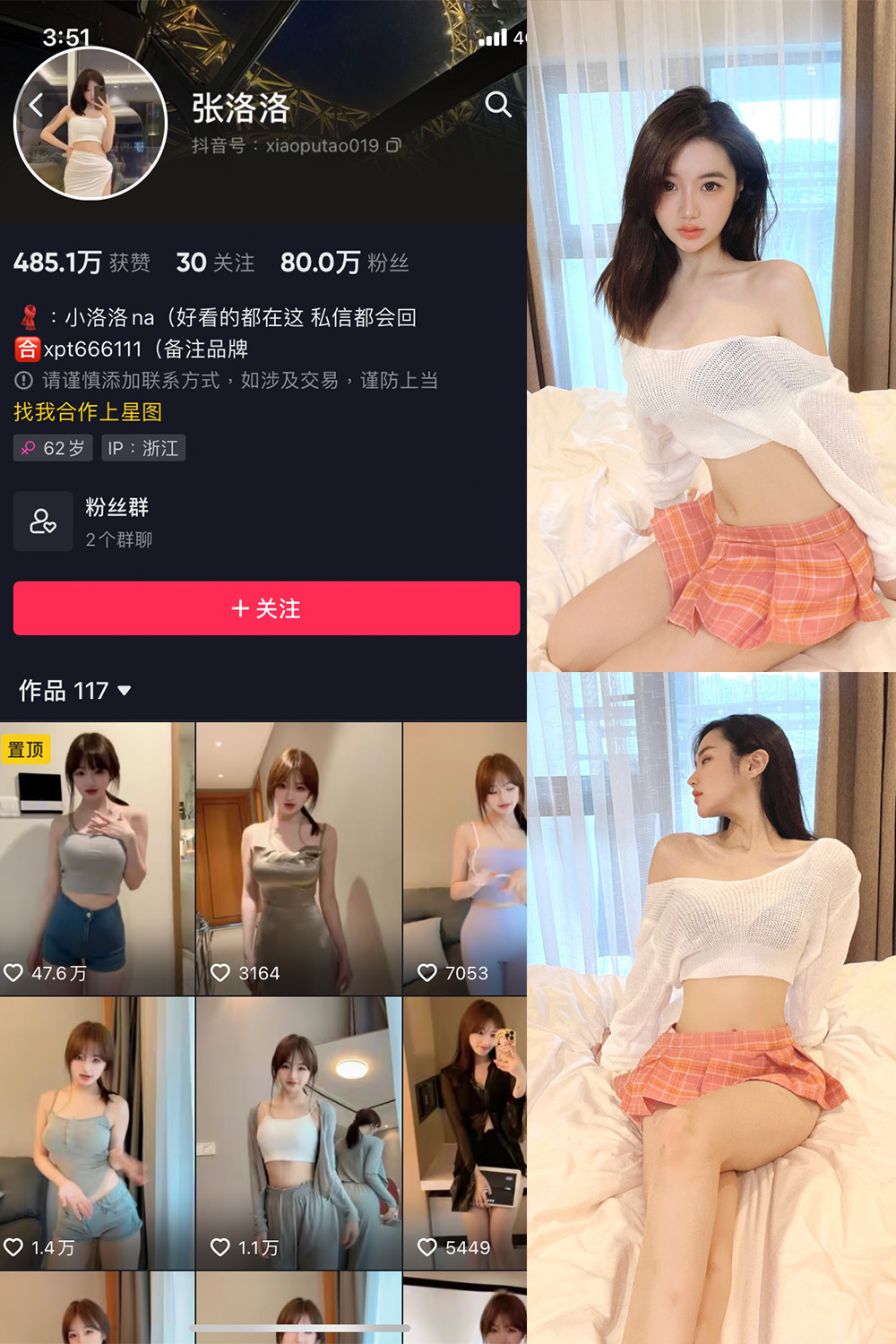 图片[1]-抖音 张洛洛 微密圈 NO.001期  30P-慕色阁