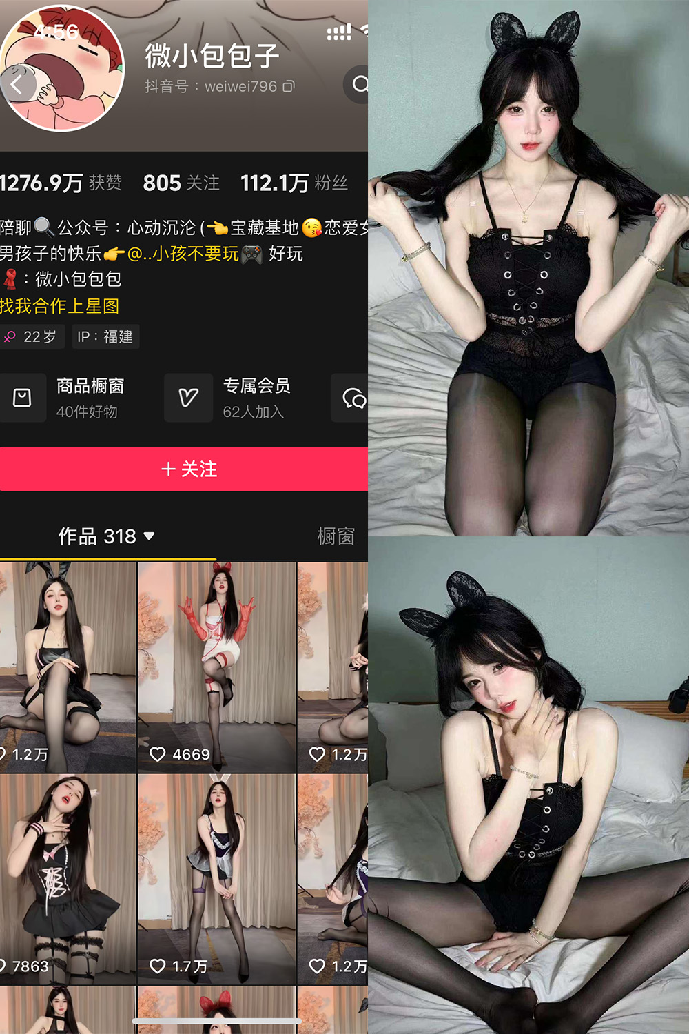 抖音 微小包包子 微密圈  NO.001期  51P3V-付费阅读