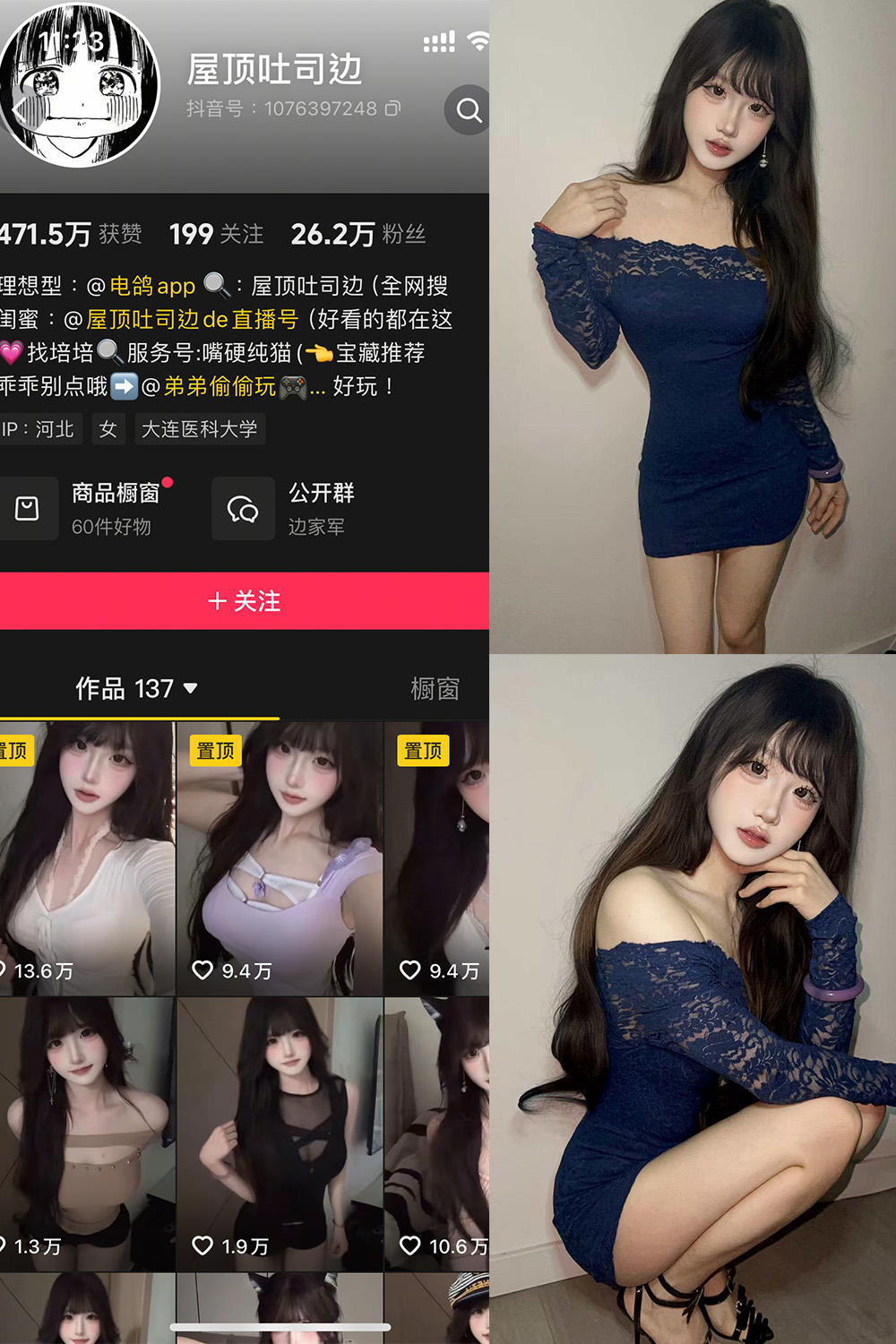 图片[1]-抖音 屋顶吐司边 岛遇 NO.001期  10P11V 最新至 2025.7.4-慕色阁