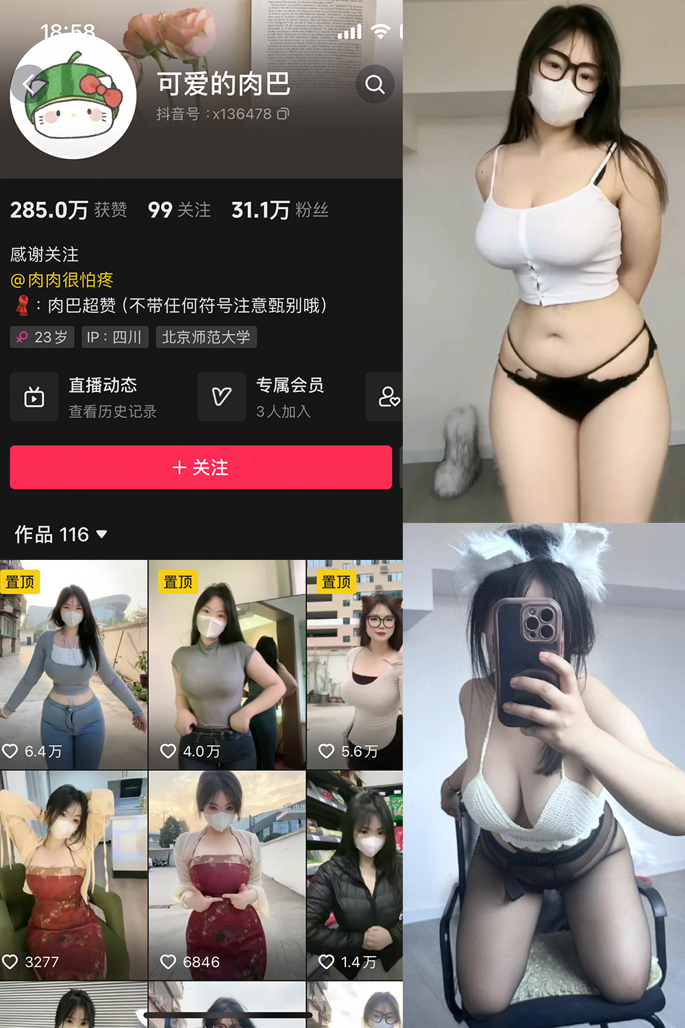 图片[1]-抖音 可爱的肉巴 微密圈  NO.014期  19P12V 最新至 2024.3.7-慕色阁